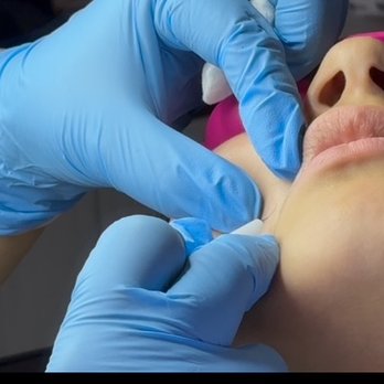 Unrooted Electrolysis - Hair Removal Near Me - Sandy, Utah Unrooted Electrolysis - Hair Removal Near Me - Sandy, Utah