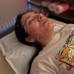 Choice Acupuncture
