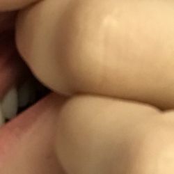 CANKER SORE THE SAME SIDE