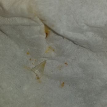 Boca Burger - The glass shard I found in my patty. - Burgers Near Me - Claremont, California
