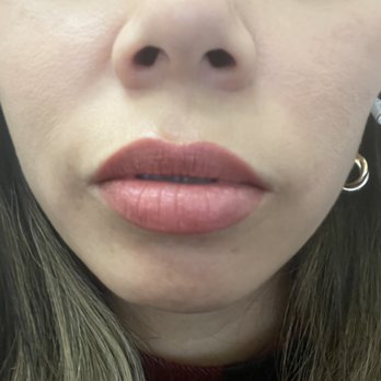Tanya Kachanova - 1 day after blushing - Permanent Makeup Near Me