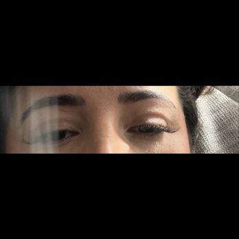 Yao Wang, MD - Eyesthetica - Upper bleph by Dr. Wang. - Ophthalmologists Near Me - Irvine, California Yao Wang, MD - Eyesthetica - Upper bleph by Dr. Wang. - Ophthalmologists Near Me - Irvine, California