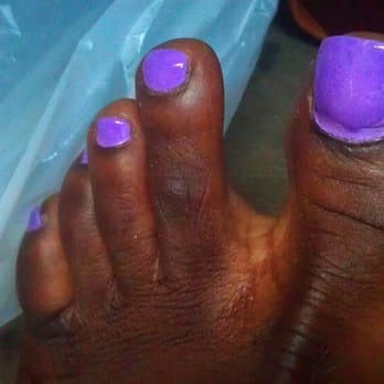 Fantasy Nail - Hot mess pedicure at Fantasy Nails. - Nail Technicians Near Me - Takoma Park, Maryland Fantasy Nail - Hot mess pedicure at Fantasy Nails. - Nail Technicians Near Me - Takoma Park, Maryland