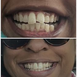 James H Nottingham, DMD - I inquired about evening out my front teeth and within that same visit he accomplished it flawlessly.