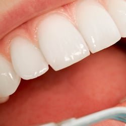 Dentica