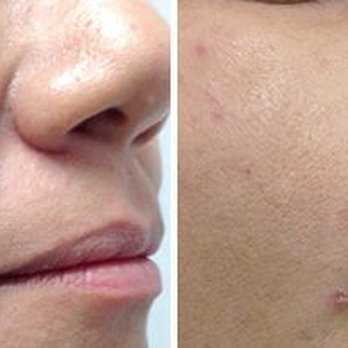 Equilibrium Beauty MD - Medical Spas Near Me - Miami, Florida
