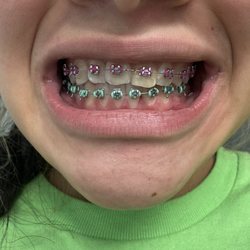 Trident Dental - Braces!
