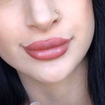 Kalsow Plastic Surgery - My lips look perfect. Thank you!! - Plastic Surgeons Near Me - New York, New York Kalsow Plastic Surgery - My lips look perfect. Thank you!! - Plastic Surgeons Near Me - New York, New York