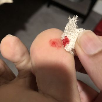 The Standard at New Brunswick - Stubbed toe due to nails under carpet - University Housing Near Me - New Brunswick, New Jersey