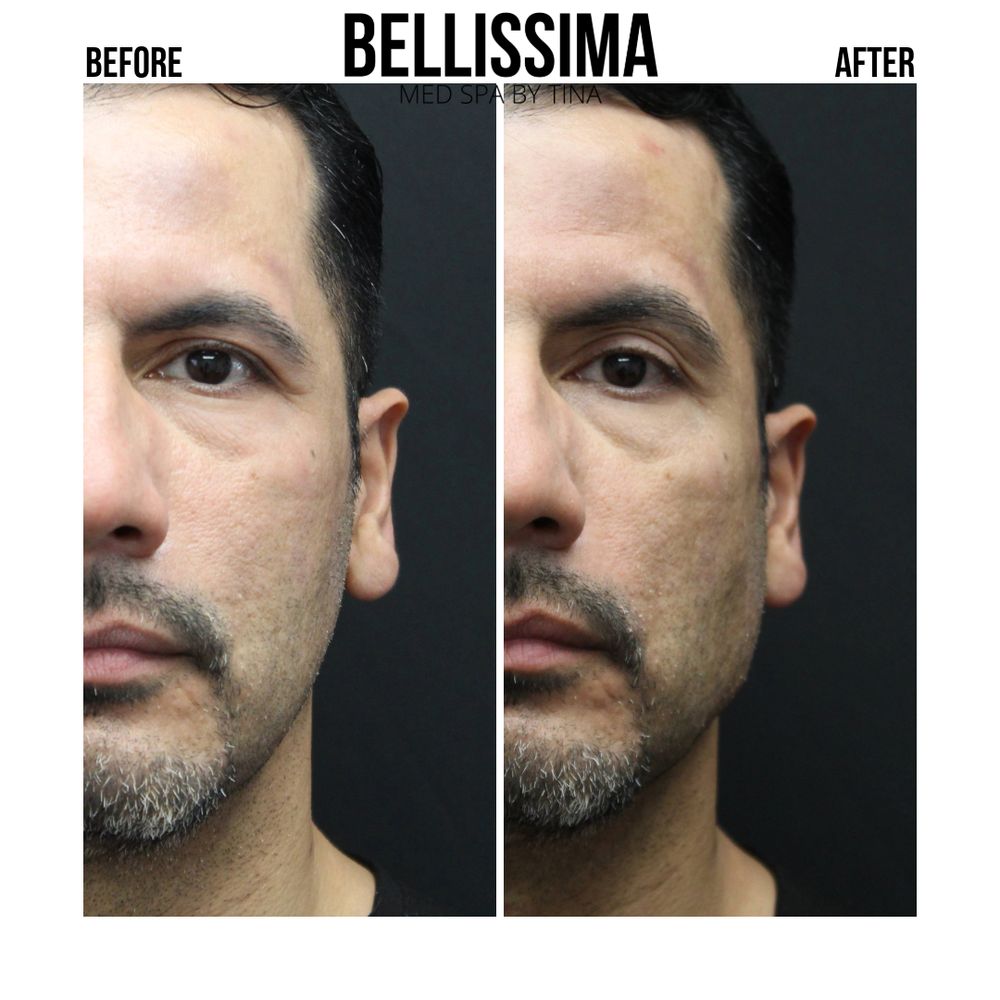Bellissima Med Spa By Tina Logo