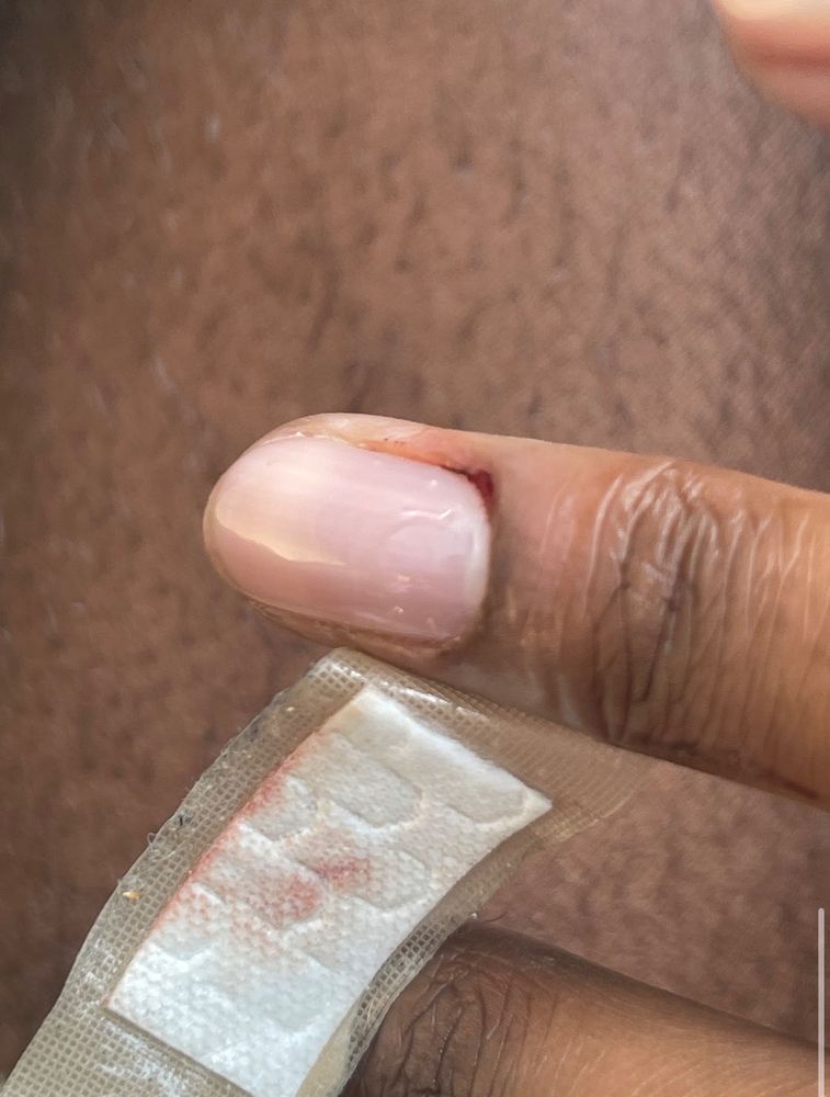 Tips and Toes by Phillip