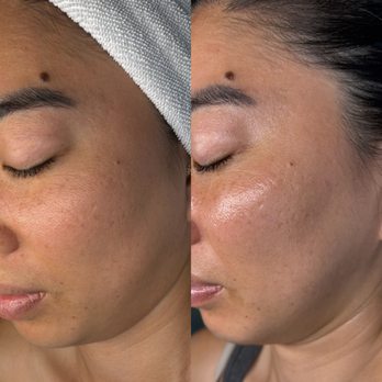 Skin Intentions & Wellness - Skin Care Near Me - Honolulu, Hawaii Skin Intentions & Wellness - Skin Care Near Me - Honolulu, Hawaii