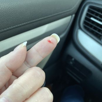 Triangle Nails - Injured finger. - Nail Salons Near Me - Portage, Michigan