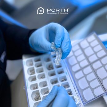 Personalized Orthodontics - indirect bonding for braces - Orthodontists Near Me - Bellevue, Washington Personalized Orthodontics - indirect bonding for braces - Orthodontists Near Me - Bellevue, Washington