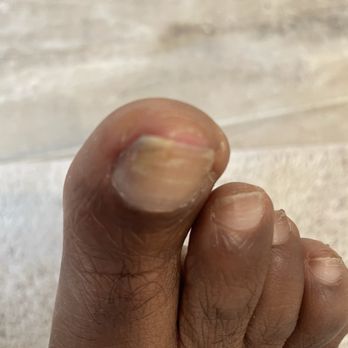 Excellent Nails - Right toe - Nail Salons Near Me - Mountain View, California Excellent Nails - Right toe - Nail Salons Near Me - Mountain View, California