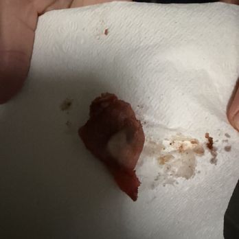 Wonder Food Bakery - A piece of bone my daughter found inside her pork bun, luckily she didn't crack her tooth or swallow it. - Bakeries Near Me - Oakland, California Wonder Food Bakery - A piece of bone my daughter found inside her pork bun, luckily she didn't crack her tooth or swallow it. - Bakeries Near Me - Oakland, California