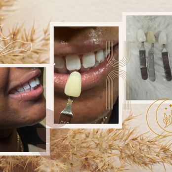 Lady Stardust Artistry - Teeth Whitening Near Me - Temecula, California Lady Stardust Artistry - Teeth Whitening Near Me - Temecula, California