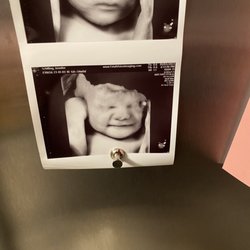 Fetal Vision Imaging