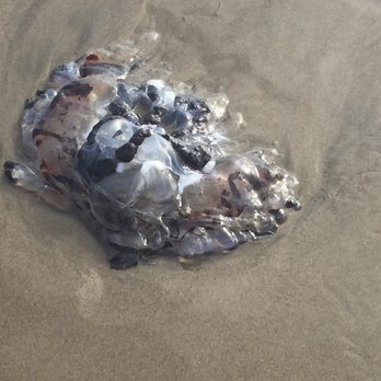 Liza Shiff, MD - Yes--- this is a jellyfish! - Family Practice Near Me - Mountain View, California Liza Shiff, MD - Yes--- this is a jellyfish! - Family Practice Near Me - Mountain View, California