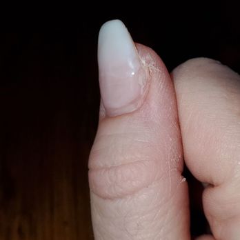Bebe Nails - Bad nail job - Nail Salons Near Me - West Chester, Pennsylvania Bebe Nails - Bad nail job - Nail Salons Near Me - West Chester, Pennsylvania