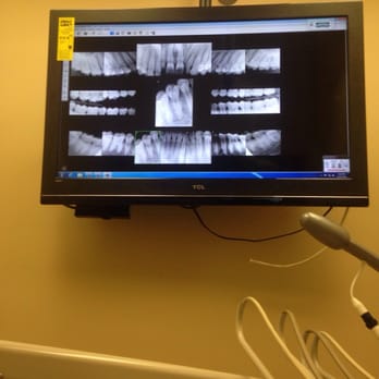 Allure Dental Arts - X rays - Cosmetic Dentists Near Me - El Monte, California Allure Dental Arts - X rays - Cosmetic Dentists Near Me - El Monte, California