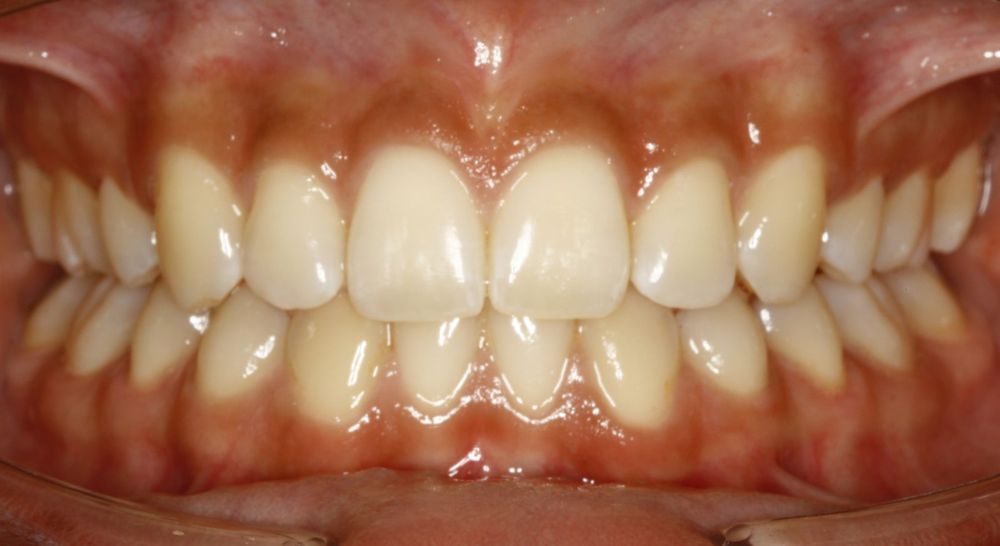 RICHARD D CHRISTENSEN, DDS MS Updated September 2024 721 N 39th Ave