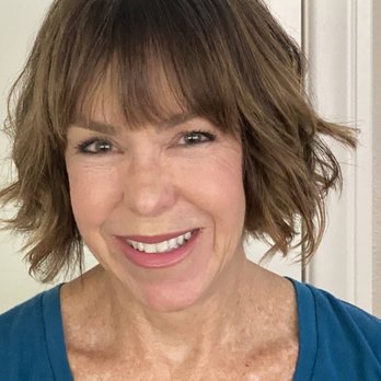 Sandhya Gandhi, MD - 24 hours post lip injections - Age 63 - Dermatologists Near Me - Mission Viejo, California Sandhya Gandhi, MD - 24 hours post lip injections - Age 63 - Dermatologists Near Me - Mission Viejo, California