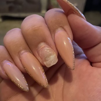 Greenfield Nails & Spa - Gilbert - Nail infection - Nail Salons Near Me - Gilbert, Arizona