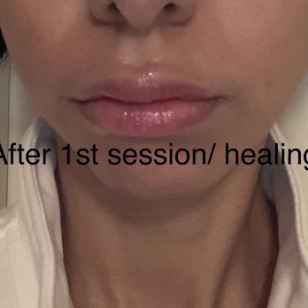 Soft Touch Microblading - Pink- Lip blush after 1st session and recovery. - Eyebrow Services Near Me - Park Ridge, Illinois
