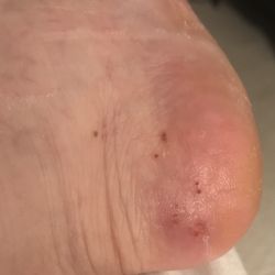 Posh Nail Spa II - The gel and tool used to removed dead skin should be illegal. She scrubbed until I had multiple gouges in my feet and I had to say stop!
