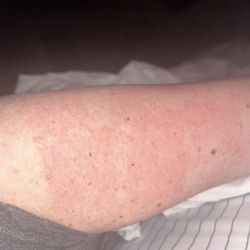 Radiance Rx Skin & Aesthetics