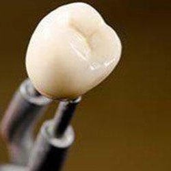 Wesmark Family Dentistry - Implants at incredible prices!