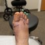 Northstate Foot & Ankle