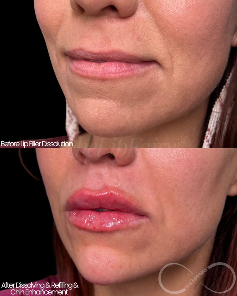 The Lip Fairy Beauty Bar Logo