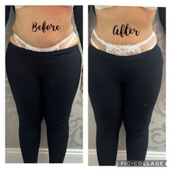 Sugar Bae Beauty Bar - Lymphatic drainage massage