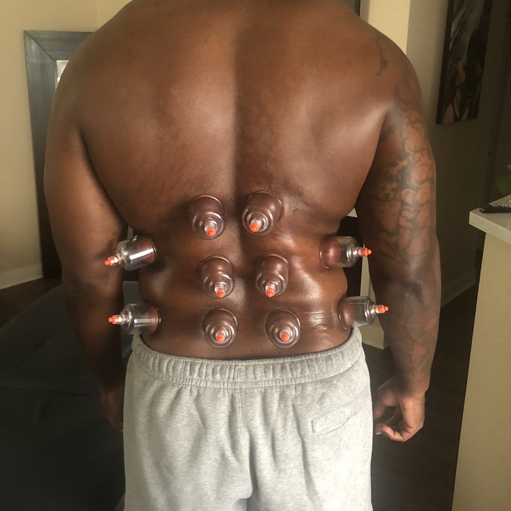 The Massage Dude - Cupping method - Massage Therapy Near Me - Riverside, California