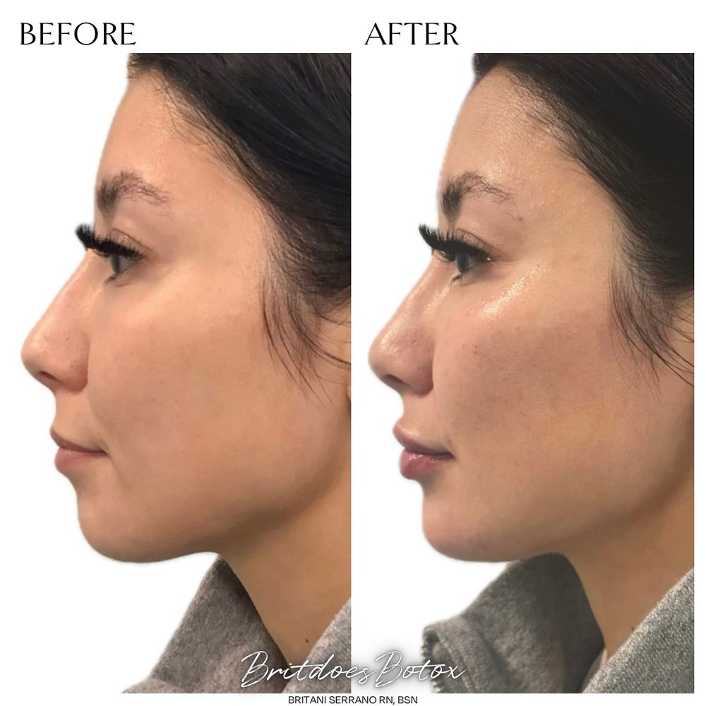 Britani Serrano, BSN, RN - Aluma Medical Aesthetics Logo