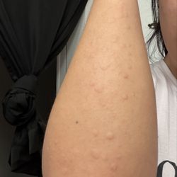 Metrolux Dine-in Theatres - Rash