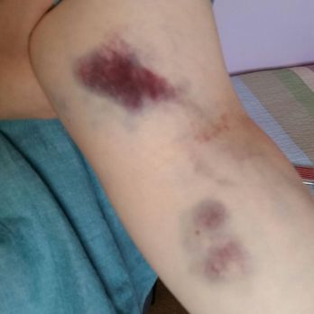 American Red Cross-Antelope Valley Chapter - Phlebotomy gone wrong. - Community Service/Non-Profit Near Me - Palmdale, California American Red Cross-Antelope Valley Chapter - Phlebotomy gone wrong. - Community Service/Non-Profit Near Me - Palmdale, California