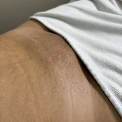 Pearl Skin LA - Brazilian