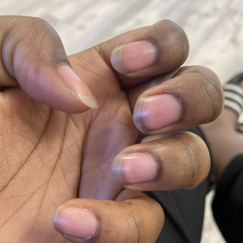 Dorita's Nails - Horrible before - Nail Salons Near Me - Rialto, California