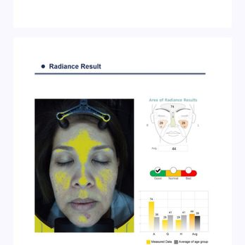 CKE Skincare - Skin Analysis just like in Korea! - Skin Care Near Me - Los Angeles, California CKE Skincare - Skin Analysis just like in Korea! - Skin Care Near Me - Los Angeles, California