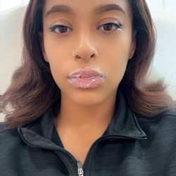 Radiant Beauty And Health - Numbing process BEFORE PHOTO