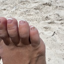 New Image Nails - More views of terrible work on a gel pedicure after 4 days - Nail Salons Near Me - Middletown, Delaware