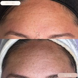 Sol Aesthetics By Anaiz - 3 month clear skin