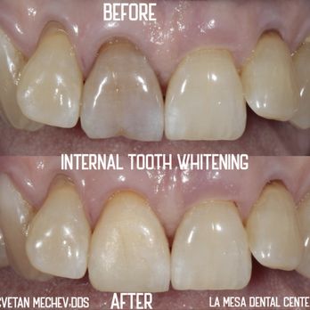 La Mesa Dental Center - General Dentistry Near Me - La Mesa, California La Mesa Dental Center - General Dentistry Near Me - La Mesa, California