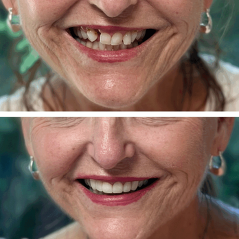Smile Solutions Dentistry - Cosmetic Dentists Near Me - Tustin, California Smile Solutions Dentistry - Cosmetic Dentists Near Me - Tustin, California