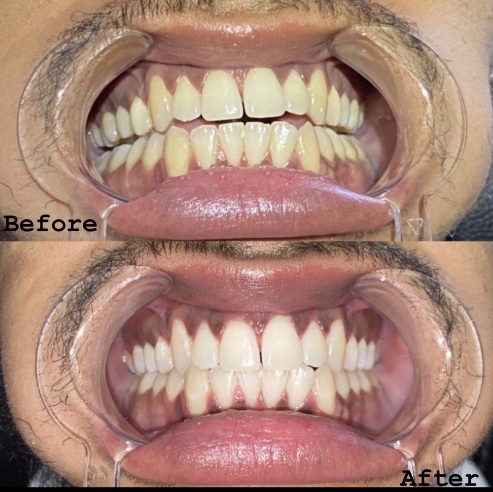 LAS VEGAS TEETH WHITENING TRAINING & CERTIFICATION COURSE Updated