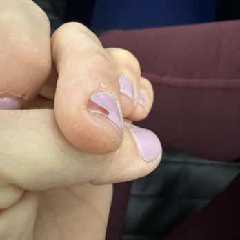 Q Spa - 3.5 days after gel manicure - Waxing Near Me - San Francisco, California Q Spa - 3.5 days after gel manicure - Waxing Near Me - San Francisco, California
