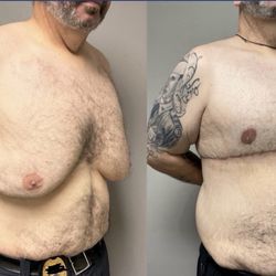 Godwin Plastic Surgery - Before and after